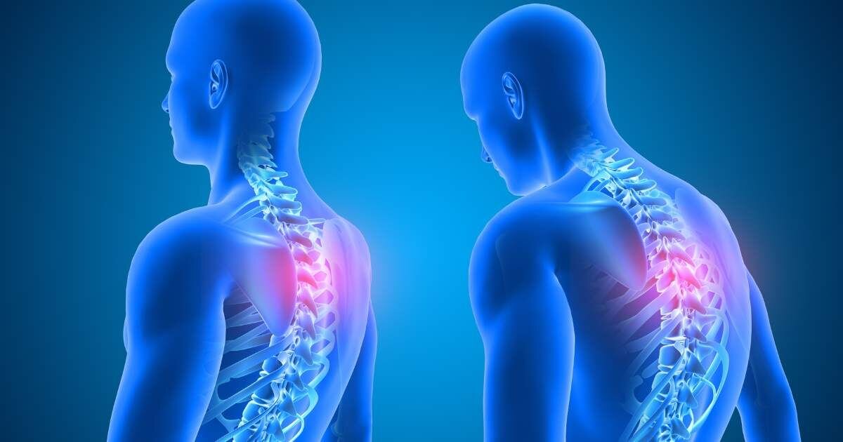 two transparent body figures showing spine x-ray with radiating pain points