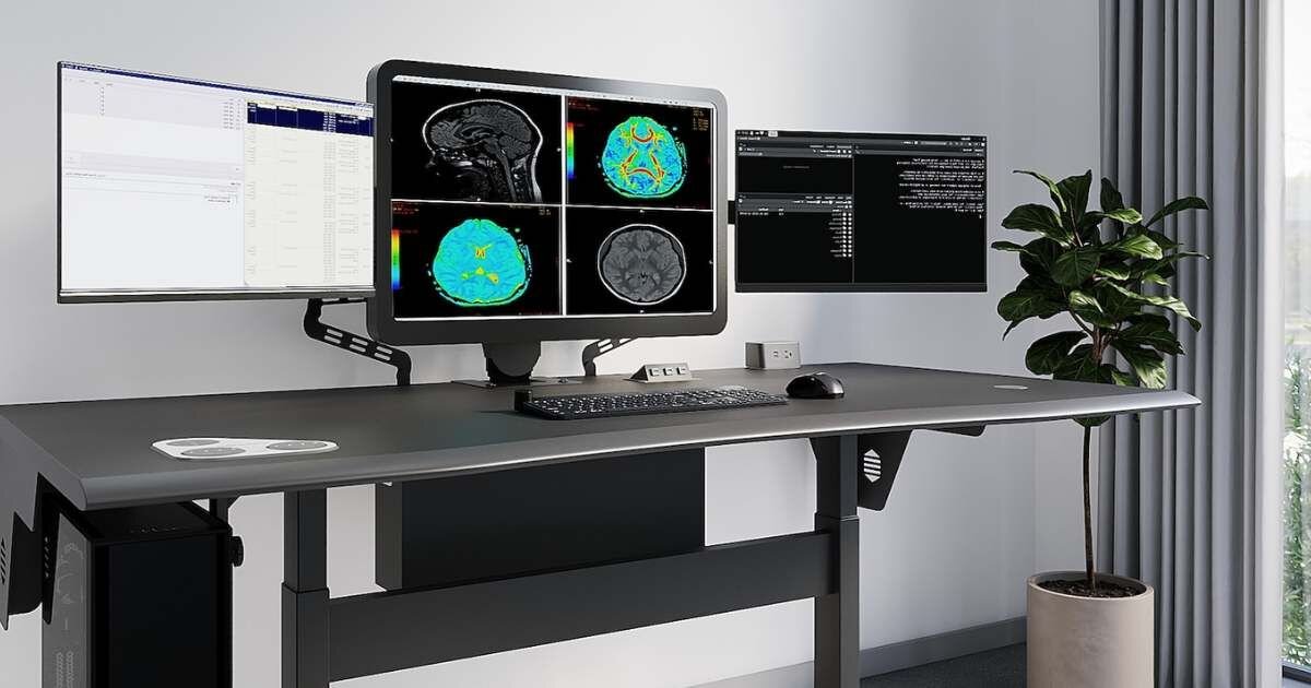 sit to stand desk with multiple monitors showcasing radiology scans 